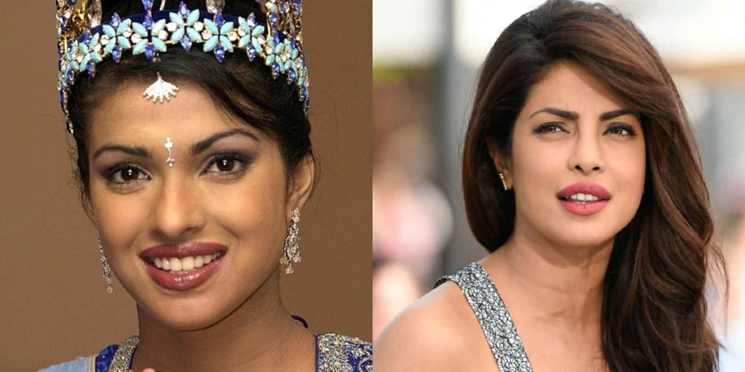 Divas before and after Plastic surgery | Piccle