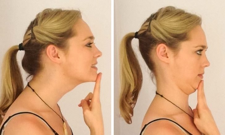 chin tuck exercise video