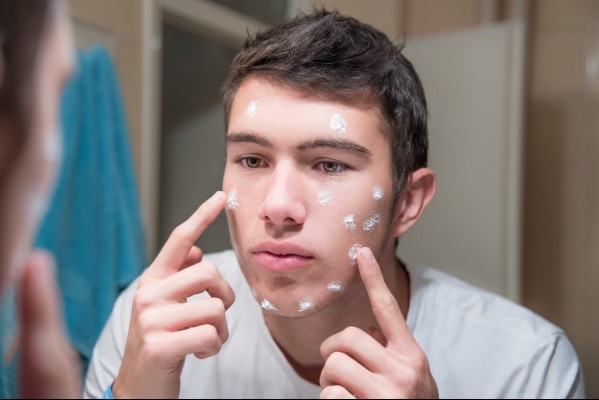 Difference between male and female skin acne issues