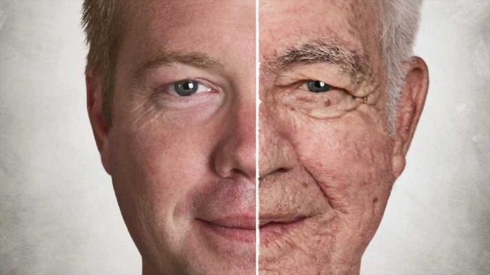 Difference between male and female skin aging